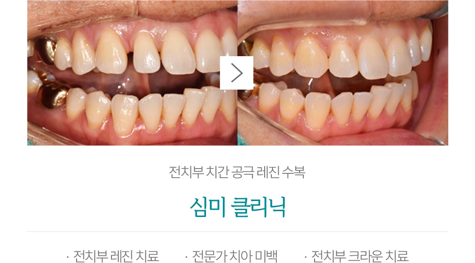 심미 클리닉