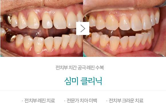 심미 클리닉